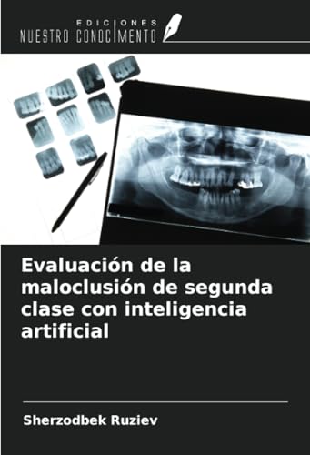 Evaluación de la maloclusión de segunda clase con inteligencia artificial von Ediciones Nuestro Conocimiento