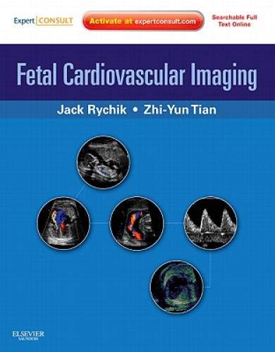 Fetal Cardiovascular Imaging: A Disease Based Approach: Expert Consult Premium Edition: Enhanced Online Features and Print