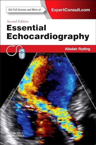 Essential Echocardiography: Expert Consult - Online & Print