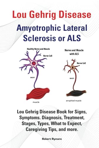 Lou Gehrig Disease, Amyotrophic Lateral Sclerosis or ALS. Lou Gehrig Disease Book for Signs, Symptoms, Diagnosis, Treatment, Stages, Types, What to Expect, Caregiving Tips, and more. Lou Gehrig Disease, Amyotrophic Lateral Sclerosis or ALS. Lou Gehrig Disease Book for Signs, Symptoms, Diagnosis, Treatment, Stages, Types, What to Expect, Caregiving Tips, and more. von Zoodoo Publishing