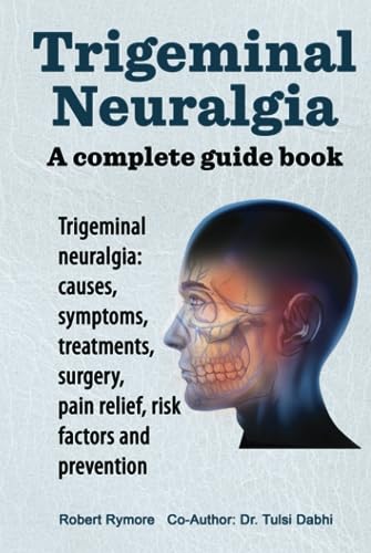 Trigeminal Neuralgia. A complete guide book. Trigeminal neuralgia: causes, symptoms, treatments, surgery, pain relief, risk factors and prevention.
