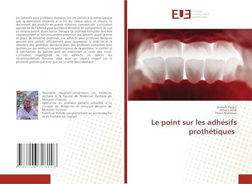 Le point sur les adhésifs prothétiques: DE von Éditions universitaires européennes