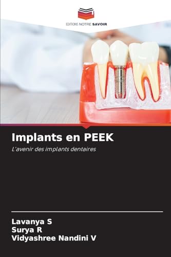 Implants en PEEK: L'avenir des implants dentaires von Editions Notre Savoir