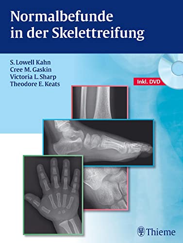 Normalbefunde in der Skelettreifung von Georg Thieme Verlag