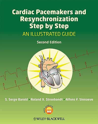 Cardiac Pacemakers and Resynchronization Step by Step: An Illustrated Guide