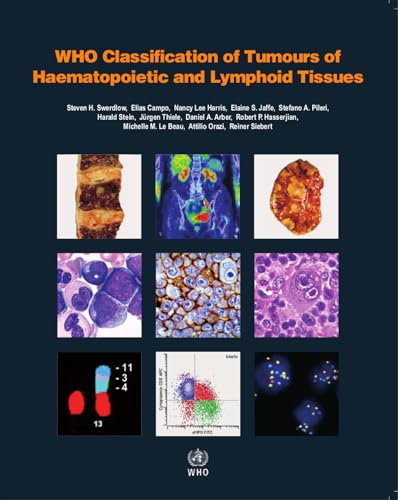 WHO Classification of Tumours of Haematopoietic and Lymphoid Tissues: Vol. 2 (World Health Organization Classification of Tumours, Band 2)