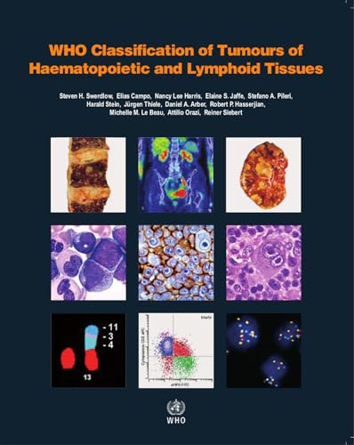 WHO Classification of Tumours of Haematopoietic and Lymphoid Tissues: Vol. 2 (World Health Organization Classification of Tumours, Band 2) von World Health Organization