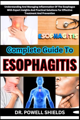 COMPLETE GUIDE TO ESOPHAGITIS: Understanding And Managing Inflammation Of The Esophagus With Expert Insights And Practical Solutions For Effective Treatment And Prevention von Independently published