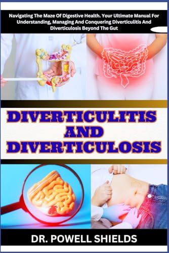 DIVERTICULITIS AND DIVERTICULOSIS: Navigating The Maze Of Digestive Health. Your Ultimate Manual For Understanding, Managing And Conquering Diverticulitis And Diverticulosis Beyond The Gut von Independently published