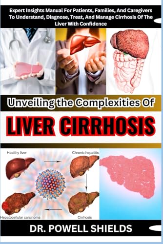 Unveiling The Complexities Of LIVER CIRRHOSIS: Expert Insights Manual For Patients, Families, And Caregivers To Understand, Diagnose, Treat, And Manage Cirrhosis Of The Liver With Confidence von Independently published
