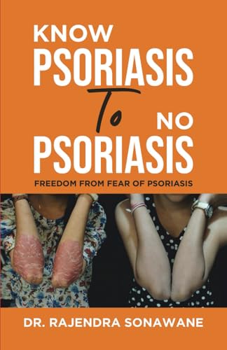 Know Psoriasis To No Psoriasis: Freedom from Fear of Psoriasis Know Psoriasis To No Psoriasis: Freedom from Fear of Psoriasis von PENMAN BOOKS