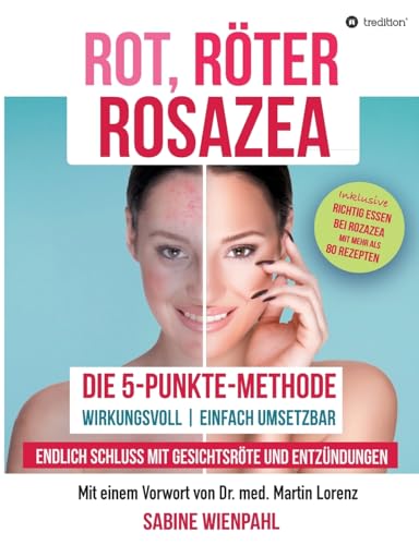 ROT RÖTER ROSAZEA: Die "5-Punkte-Methode" – Endlich Schluss mit Gesichtsröte und Entzündungen