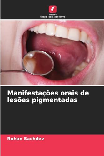 Manifestações orais de lesões pigmentadas von Edições Nosso Conhecimento