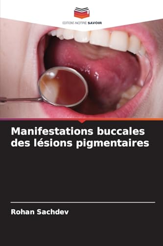 Manifestations buccales des lésions pigmentaires von Editions Notre Savoir
