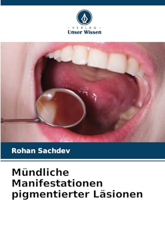 Mündliche Manifestationen pigmentierter Läsionen von Verlag Unser Wissen