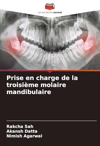 Prise en charge de la troisième molaire mandibulaire von VDM Verlag