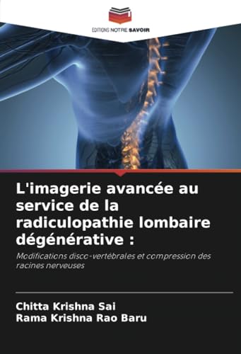 L'imagerie avancée au service de la radiculopathie lombaire dégénérative :: Modifications disco-vertébrales et compression des racines nerveuses von Editions Notre Savoir