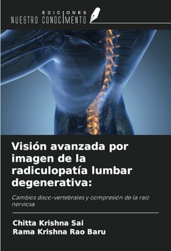 Visión avanzada por imagen de la radiculopatía lumbar degenerativa:: Cambios disco-vertebrales y compresión de la raíz nerviosa von Ediciones Nuestro Conocimiento