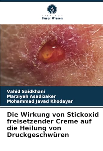 Die Wirkung von Stickoxid freisetzender Creme auf die Heilung von Druckgeschwüren von Verlag Unser Wissen