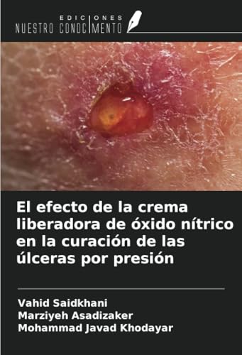 El efecto de la crema liberadora de óxido nítrico en la curación de las úlceras por presión von Ediciones Nuestro Conocimiento