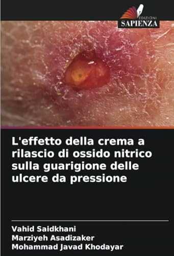 L'effetto della crema a rilascio di ossido nitrico sulla guarigione delle ulcere da pressione von Edizioni Sapienza