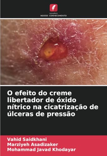 O efeito do creme libertador de óxido nítrico na cicatrização de úlceras de pressão von Edições Nosso Conhecimento