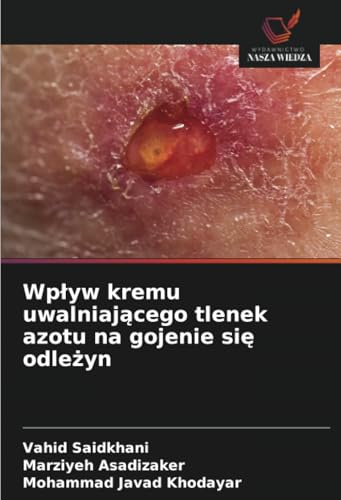 Wpływ kremu uwalniającego tlenek azotu na gojenie się odleżyn: DE von Wydawnictwo Nasza Wiedza