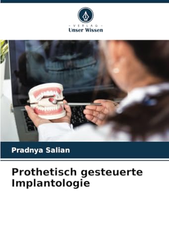 Prothetisch gesteuerte Implantologie: DE von Verlag Unser Wissen