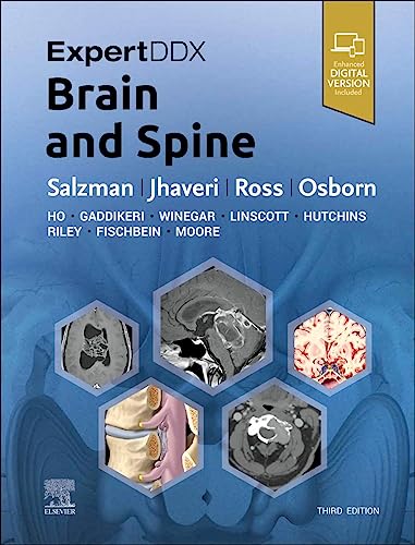 ExpertDDx: Brain and Spine von Elsevier