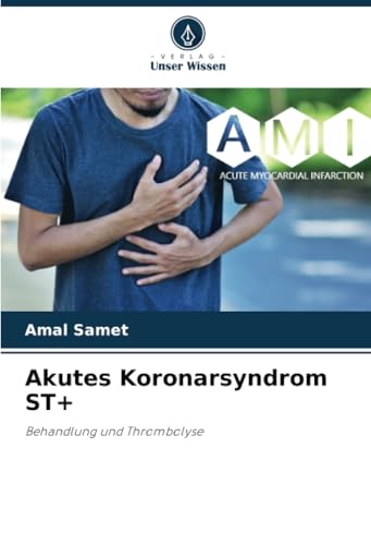 Akutes Koronarsyndrom ST+: Behandlung und Thrombolyse von Verlag Unser Wissen