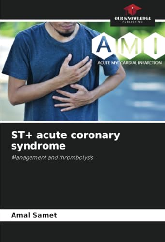 ST+ acute coronary syndrome: Management and thrombolysis von Our Knowledge Publishing