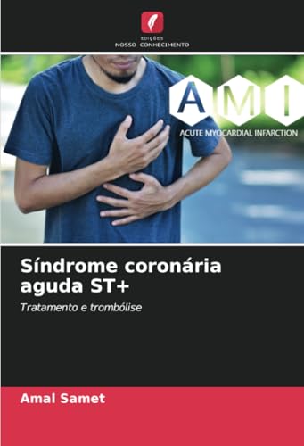 Síndrome coronária aguda ST+: Tratamento e trombólise von Edições Nosso Conhecimento