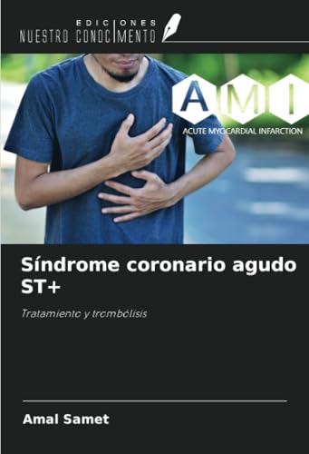Síndrome coronario agudo ST+: Tratamiento y trombólisis von Ediciones Nuestro Conocimiento