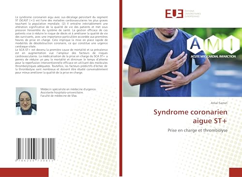 Syndrome coronarien aigue ST+: Prise en charge et thrombolyse von Éditions universitaires européennes