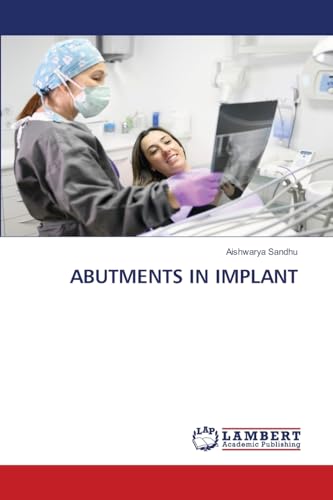 ABUTMENTS IN IMPLANT: DE von LAP LAMBERT Academic Publishing