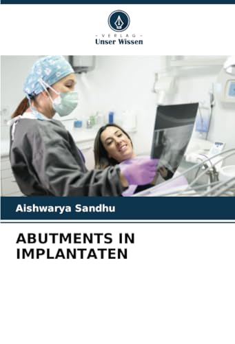 ABUTMENTS IN IMPLANTATEN: DE von Verlag Unser Wissen