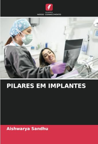 PILARES EM IMPLANTES: DE von Edições Nosso Conhecimento