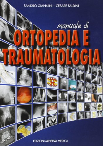 Manuale di ortopedia e traumatologia Manuale di ortopedia e traumatologia von Minerva Medica