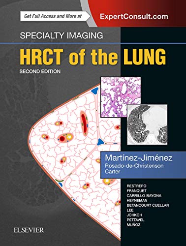 Specialty Imaging: HRCT of the Lung: Anatomic Basis, Imaging Features, Differential Diagnosis. ExpertConsult.com Specialty Imaging: HRCT of the Lung: Anatomic Basis, Imaging Features, Differential Diagnosis. ExpertConsult.com