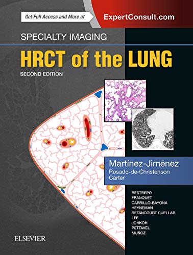 Specialty Imaging: HRCT of the Lung: Anatomic Basis, Imaging Features, Differential Diagnosis. ExpertConsult.com