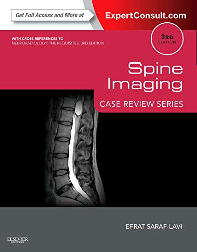 Spine Imaging: Case Review Series: Expert Consult - Online and Print von Saunders