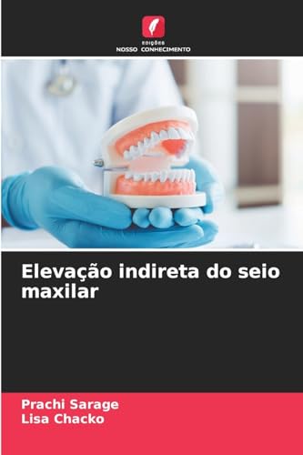 Elevação indireta do seio maxilar: DE von Edições Nosso Conhecimento