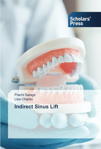 Indirect Sinus Lift: DE von Scholars' Press