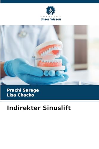 Indirekter Sinuslift: DE von Verlag Unser Wissen