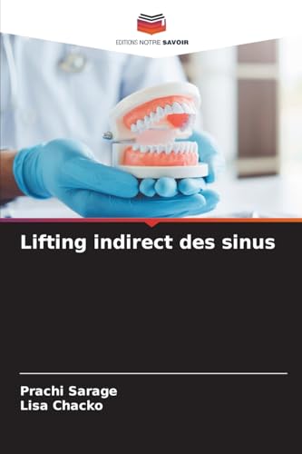 Lifting indirect des sinus von Editions Notre Savoir
