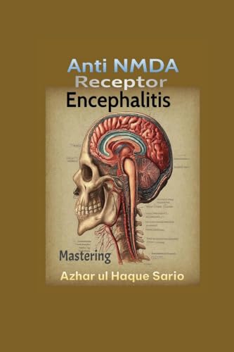 Mastering Anti NMDA Receptor Encephalitis von Azhar Sario Dubai