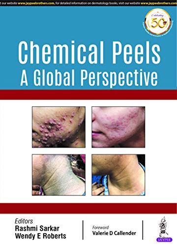 Chemical Peels: A Global Perspective von Jaypee Brothers Medical Publishers
