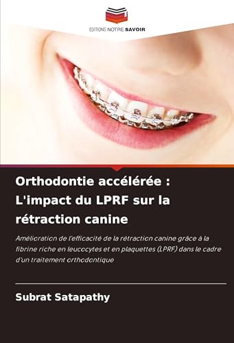 Orthodontie accélérée : L'impact du LPRF sur la rétraction canine: Amélioration de l'efficacité de la rétraction canine grâce à la fibrine riche en ... dans le cadre d'un traitement orthodontique von VDM Verlag