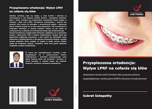 Przyspieszona ortodoncja: Wp¿yw LPRF na cofanie si¿ k¿ów: Zwi¿kszenie skuteczno¿ci retrakcji k¿ów za pomoc¿ fibryny bogatop¿ytkowej z leukocytami (LPRF) w leczeniu ortodontycznym von VDM Verlag