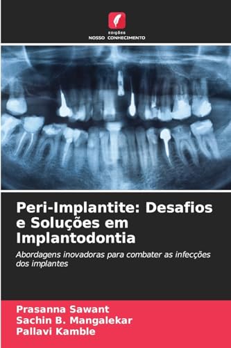 Peri-Implantite: Desafios e Soluções em Implantodontia: Abordagens inovadoras para combater as infecções dos implantes von Edições Nosso Conhecimento